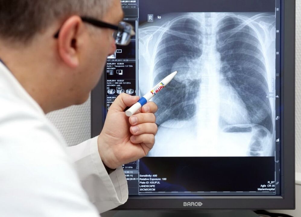arteriaalse hüpertensiooni diagnoosimine